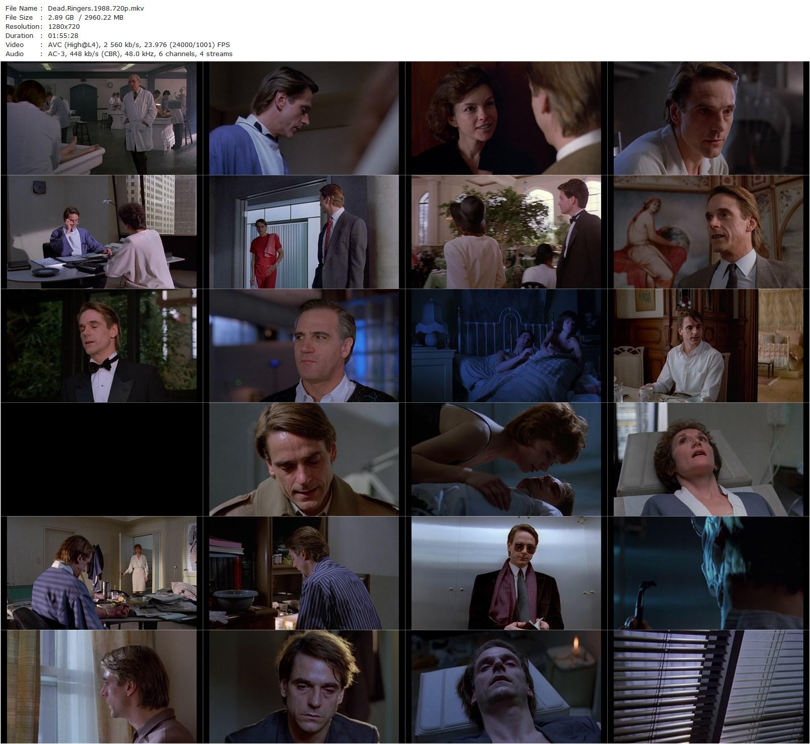 Dead Ringers (1988) David Cronenberg, Jeremy Irons, Geneviève Bujold, Heidi von Palleske-poster