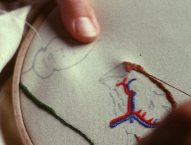 The Odds of Recovery (2002) by Su Friedrich-poster