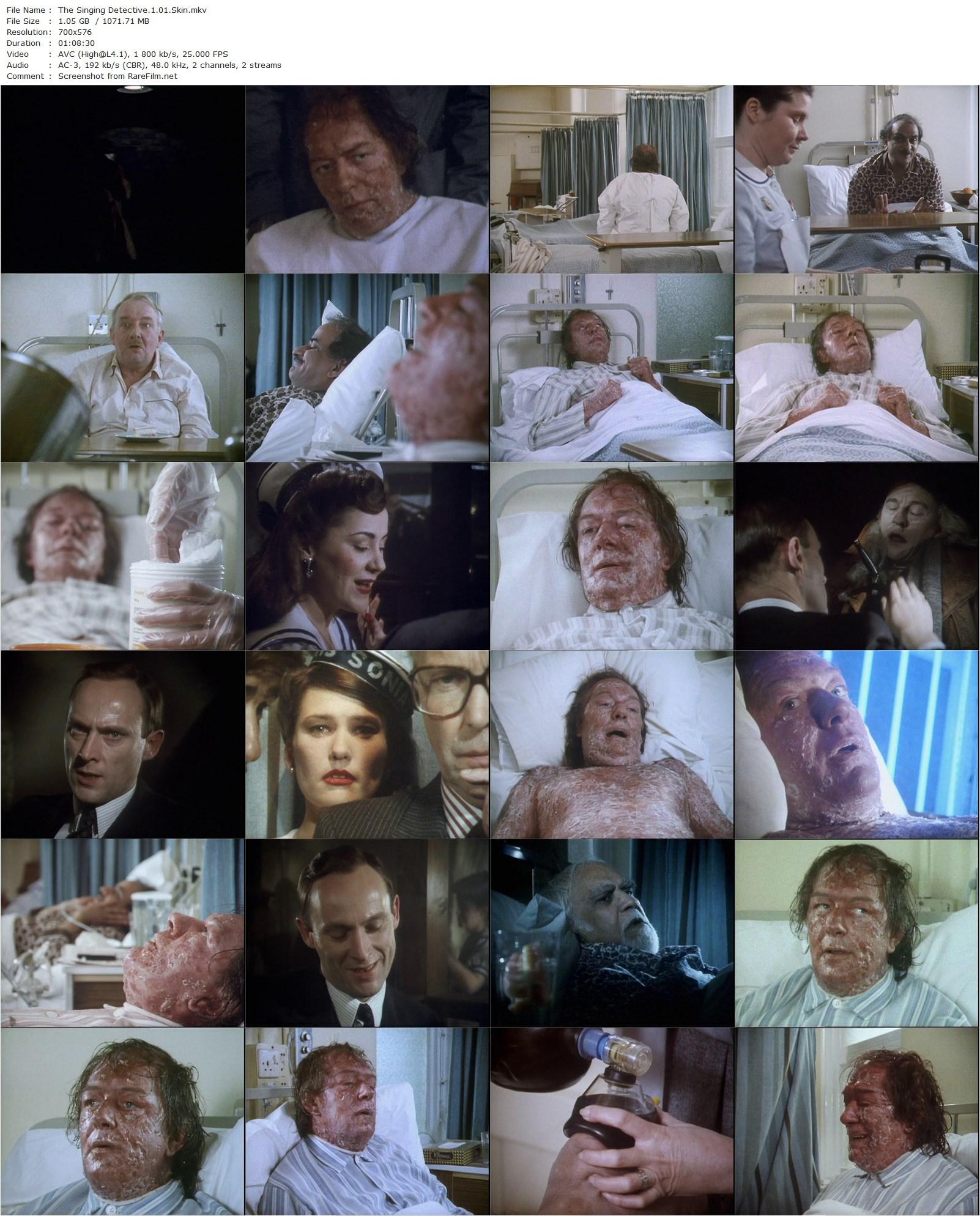 The Singing Detective (1986) Jon Amiel, Michael Gambon, Patrick Malahide, Joanne Whalley-poster